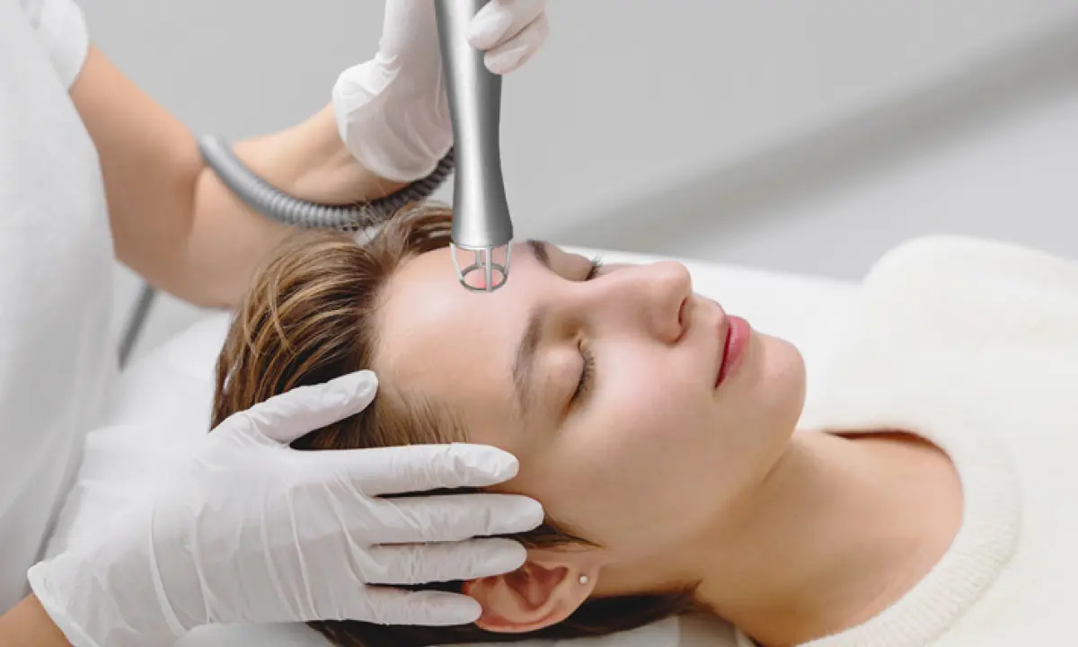 Fraktionierter CO2-Laser