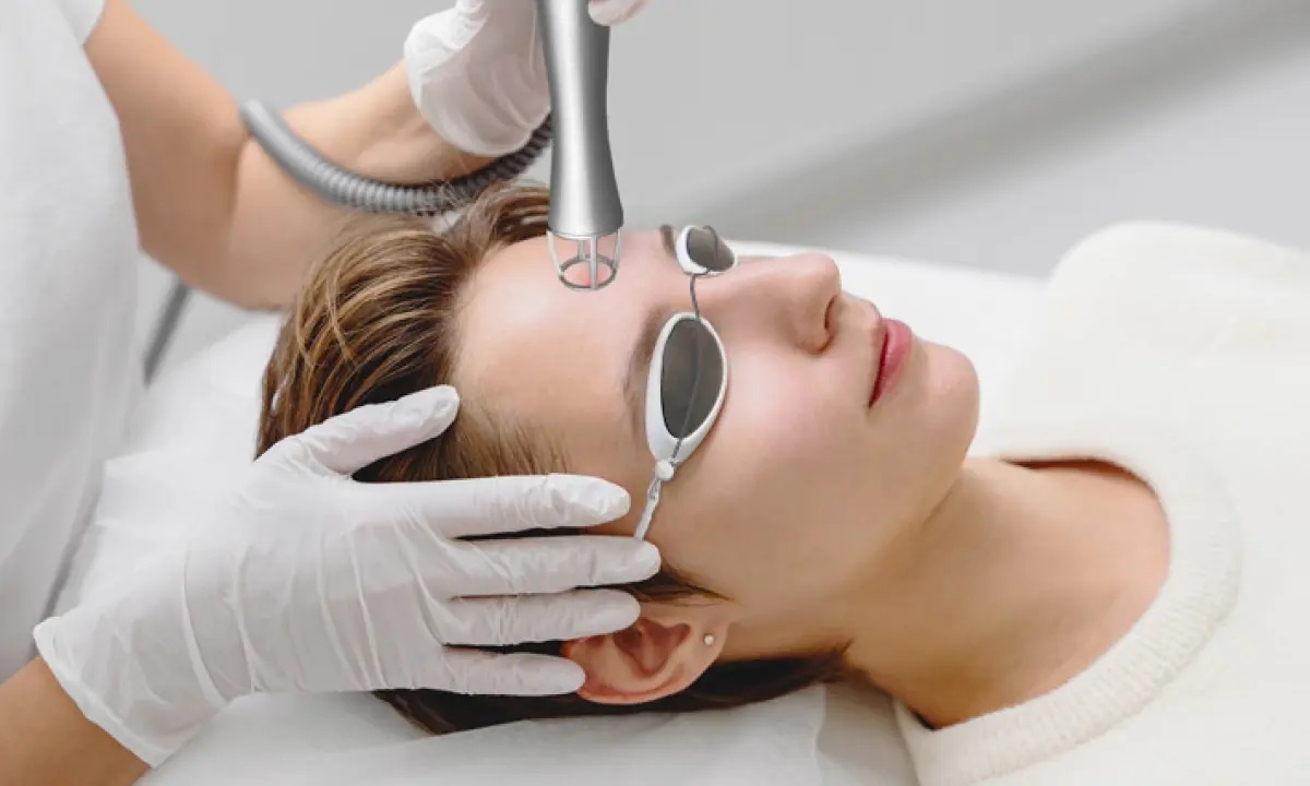 Fraktionierter CO2-Laser